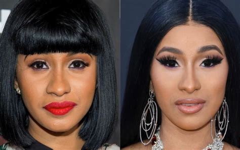 Cardi B Face Plastic Surgery Break Down Lipstick Alley