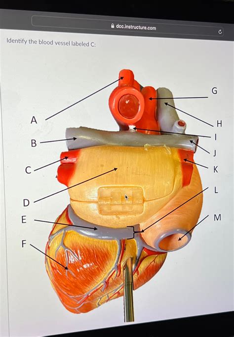 Solved Identify The Blood Vessel Labeled Chegg