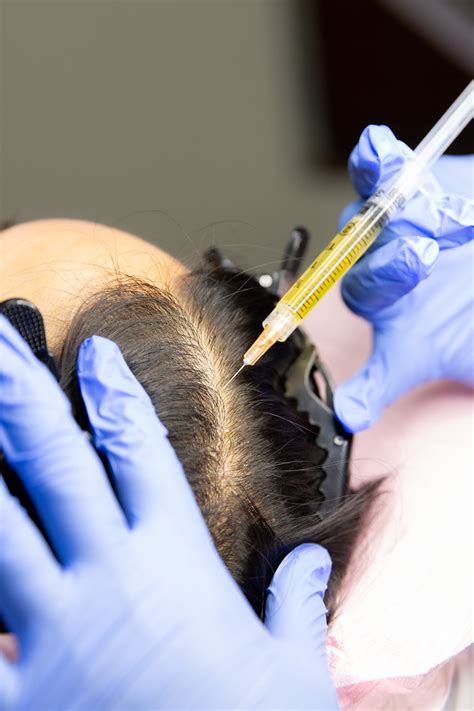 prp injections san antonio