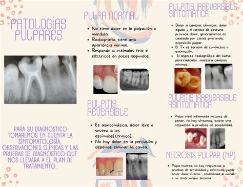 Patología pulpar Esmeralda Casanova uDocz