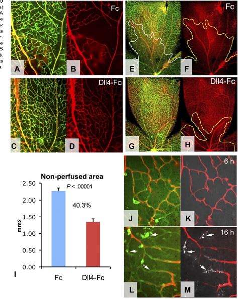 Figure From The Dll Notch Pathway Controls Postangiogenic Blood