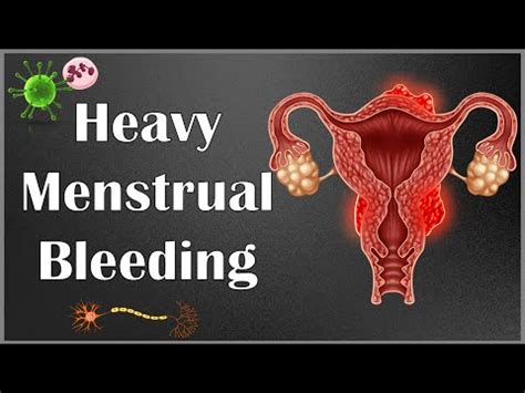 What Causes Heavy Menstrual Bleeding Menorrhagia Causes Of Heavy