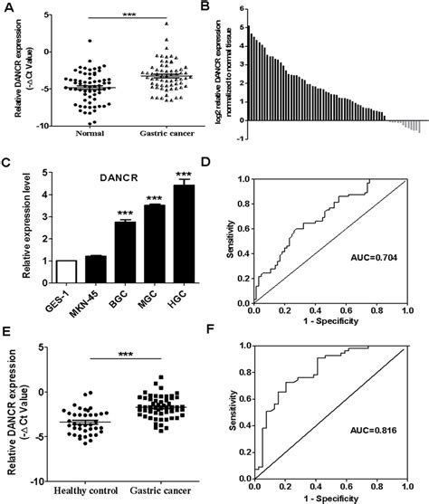 The Relative Expression Levels Of Dancr In The Tumor Tissues And Serum