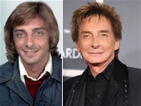 Barry Manilow Plastic Surgery Before And After Facelift Famous