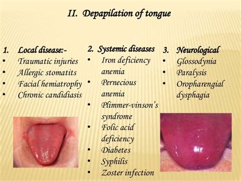 Diseases of tongue