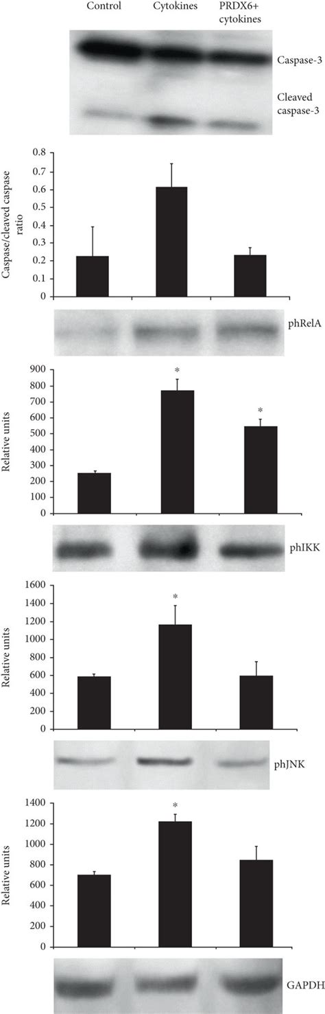 Effects Of Prdx6 On The Activation Of Caspase 3 Nf κb Ikk And Jnk Download Scientific