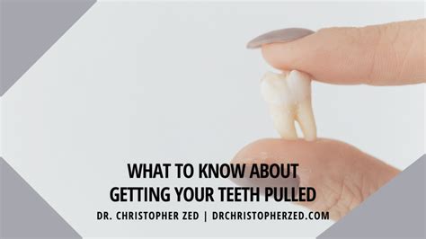 What To Know About Getting Your Teeth Pulled Dr Christopher Zed