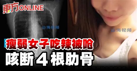 瘦弱女子吃辣被呛 咳断4根肋骨