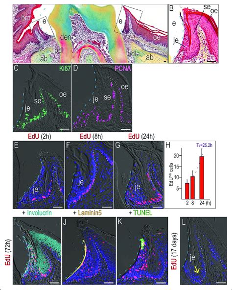 Structure Of Junctional Epithelium Is Maintained By Cell, 51% OFF