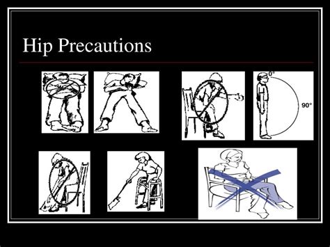 PPT - HIP FRACTURES PowerPoint Presentation, free download - ID:5465514