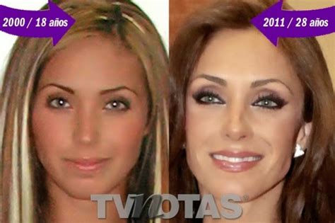 El Antes Y Despues De Anahi Telenovelas