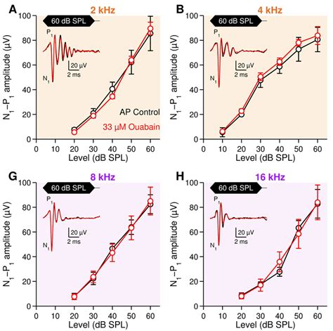 Compound Action Potential Of The Auditory Nerve In Control And Download Scientific Diagram