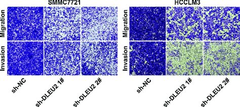 Knockdown Of Dleu Inhibited Hcc Migration And Invasion Transwell