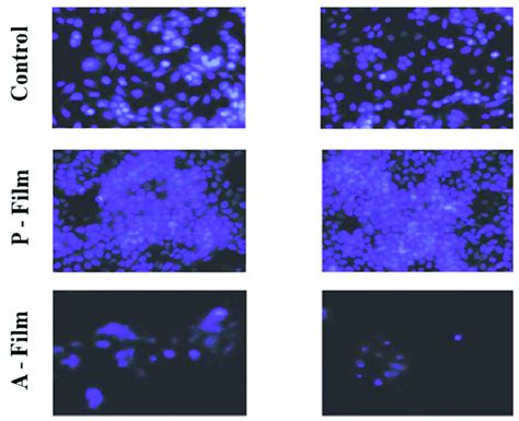 Morphology Of Mcf Cells After H In The Presence Of P Film Panel