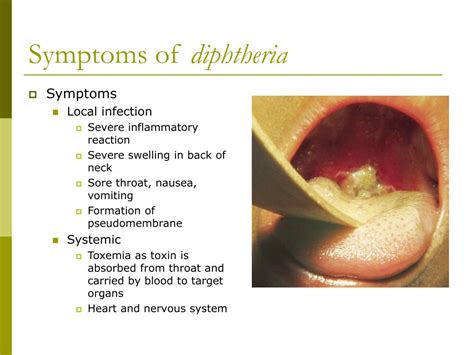 Ppt Mechanism Of Bacterial Damage And Bacterial Toxins Powerpoint