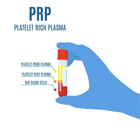 Hand Holding A Test Tube Filled With Blood For Platelet Rich Plasma