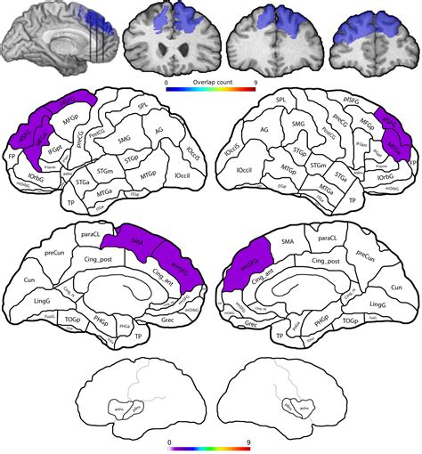 Damage To The Ventromedial Prefrontal Cortex Impairs Learning From