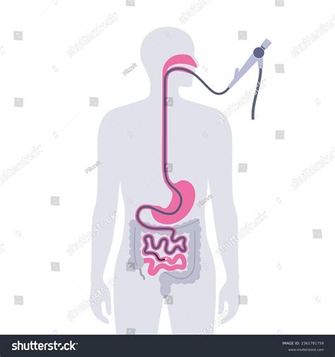 Best Esophagogastroduodenoscopy Royalty Free Images Stock Photos