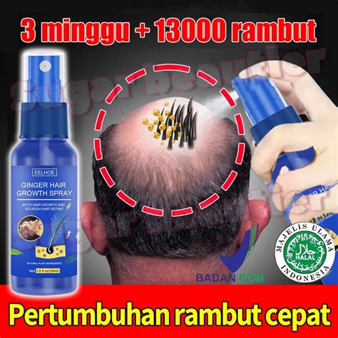 Jual Penumbuh Botak Dan Rontok Serum Anti Rambut Rontok Anti Hair Fall