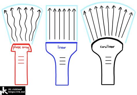 Piezoelectric Ultrasound Transducer at Scott Miles blog