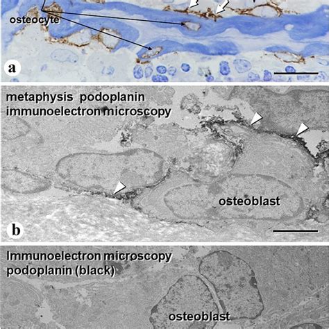 The Distribution Of Actin Filaments And Podoplanin In Osteoblasts And