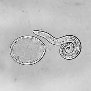 Baylisascaris Procyonis Life Cycle