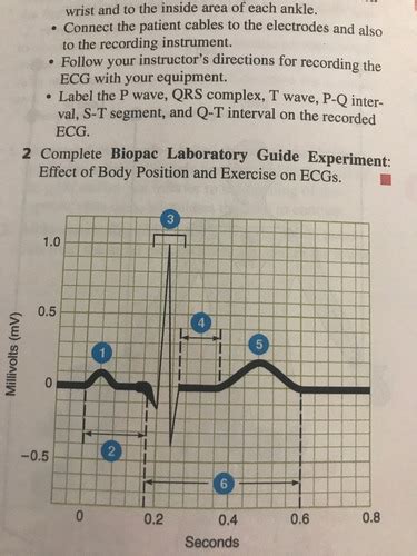 Section Of A Normal Ecg Lead Ii