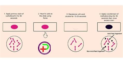 Differential Staining Gram Staining Acid Fast Staining Technique