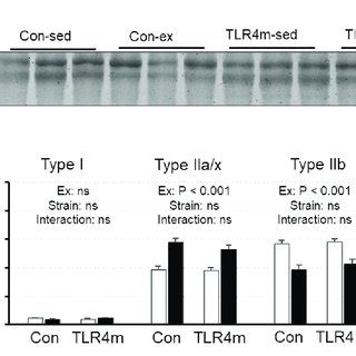 The Relative Expressions Of Myosin Heavy Chain Mhc Isoforms B In