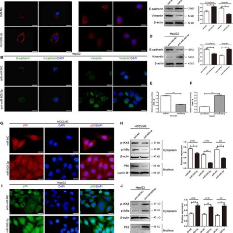 Mir P Inhibits Epithelialmesenchymal Transition Emt In Hcc