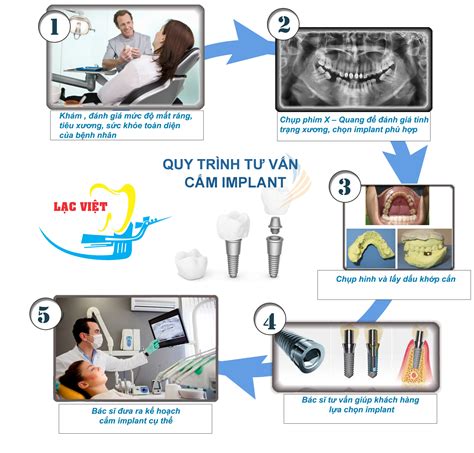 Kỹ thuật cấy ghép implant chuẩn nhất 2016