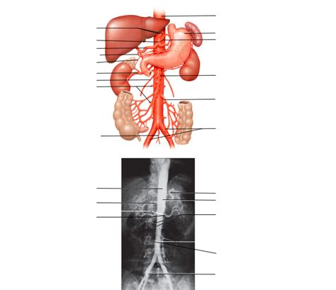 Abdominal Arteries 2 Diagram Quizlet