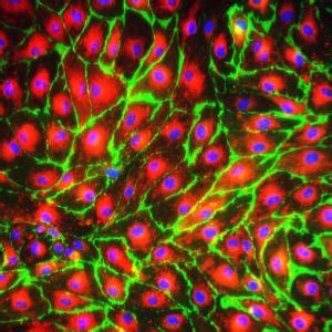 Human Dermal Microvascular Endothelial Cells Cadmec Hmvec Cell