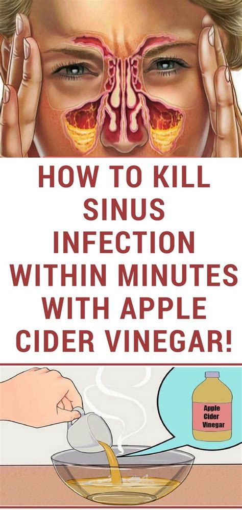 How To Kill Sinus Infection Within Minutes With Apple Cider Vinegar Wellness Magazine