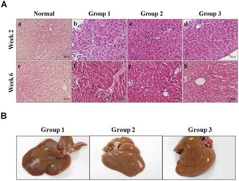 Gross Appearance And Histological Assessments Of Liver Fibrosis Induced