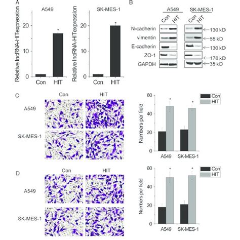 Overexpression Of Lncrna Hit Promotes The Migration And Invasion Of