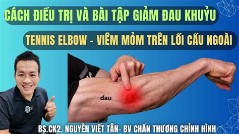 Cách điều trị và bài tập giảm đau khuỷu tay do viêm mỏm trên lồi cầu