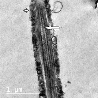 Comet Assay Of Frozen Thawed Buffalo Bull Spermatozoa After