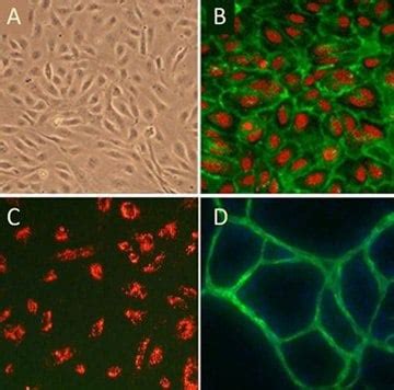 Angiogenesis Assays