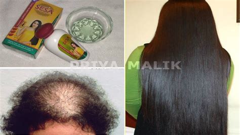 Try This 100 Effective Ayurvedic Hair Oil For Hair Loss And Hair Growth Sesa Hair Oil Priya