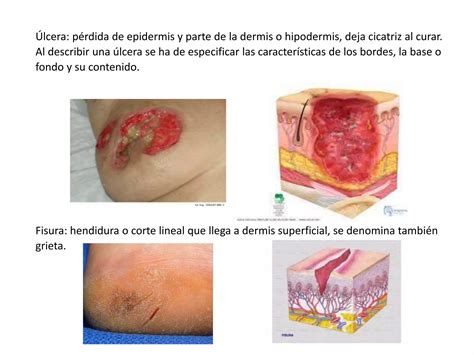 Lesiones Cut Neas Primarias Y Secundarias Pptx