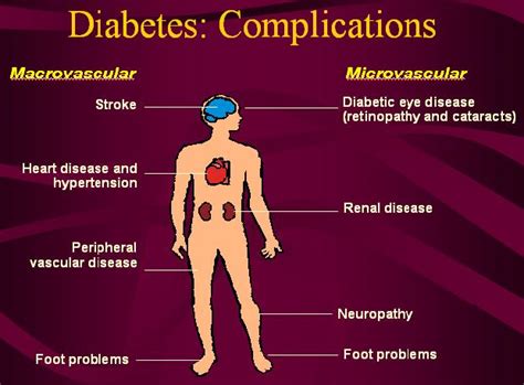 Painful Diabetic Polyneuropathy | e-algos