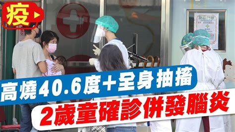 【每日必看】高燒406度全身抽搐 2歲童確診併發腦炎 20220831ctinews Ctihealthyme Youtube