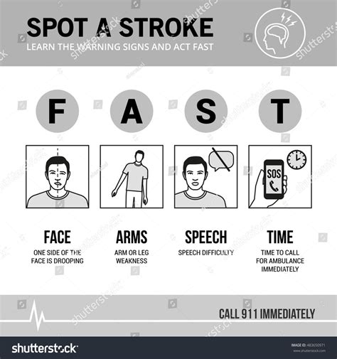 Stroke Emergency Awareness Recognition Signs Medical Stock Vector