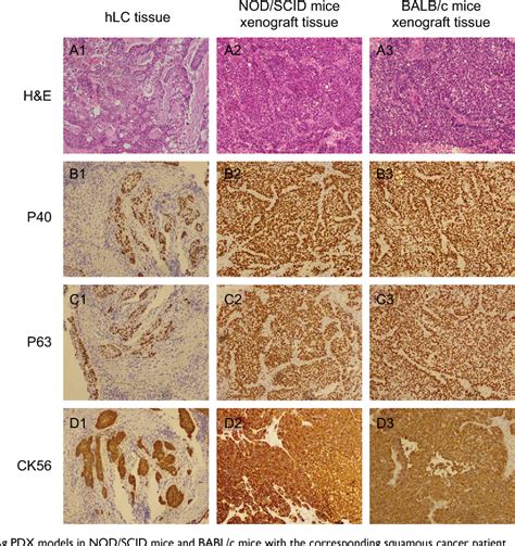 [PDF] Comparison between NOD/SCID mice and BALB/c mice for patient ...