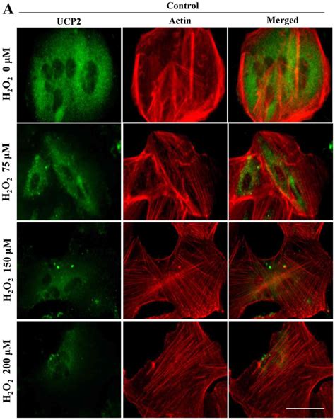 Pedf Protects Human Retinal Pigment Epithelial Cells Against Oxidative