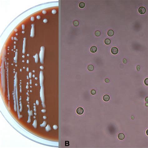 Colony Counts Of Histoplasma Capsulatum In The Spleens Of Treated Nul