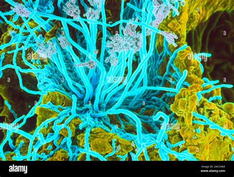 Penicillium On Bread Coloured Scanning Electron Micrograph Sem Of