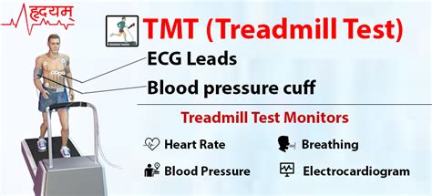 Tread Mill Test For Heart Patient At Hhcc Jaipur Dr Gaurav Singhal