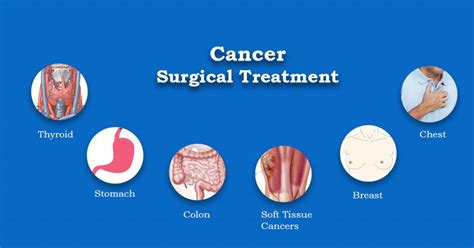 Cancer Surgery in Kochi - Dr. R. Padmakumar